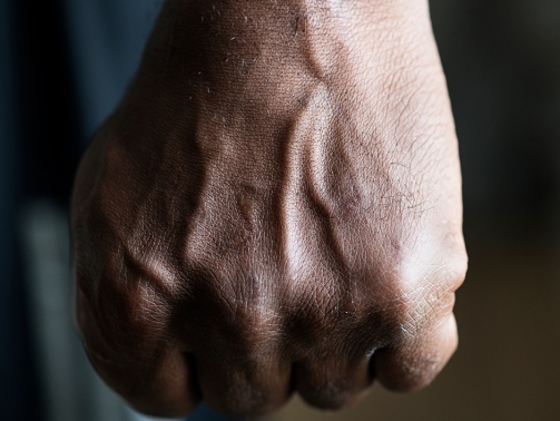 Agresividad en personas mayores - ADIEX